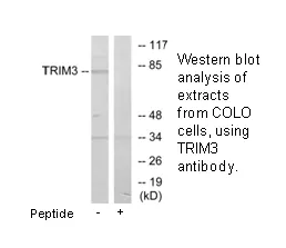 TRIM3 Antibody - image 1