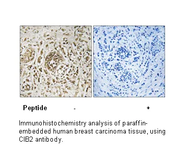 CIB2 Antibody - image 1