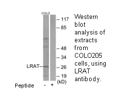 LRAT Antibody - image 2