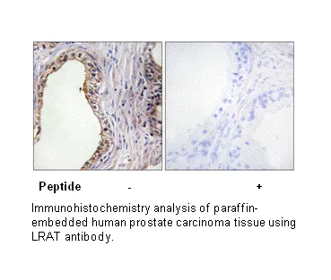 LRAT Antibody - image 3