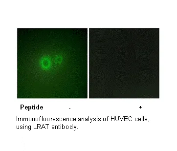 LRAT Antibody - image 1