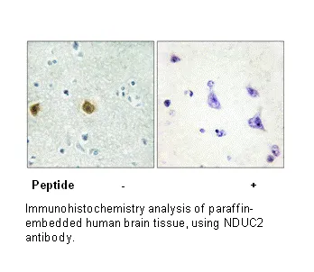 NDUC2 Antibody - image 1