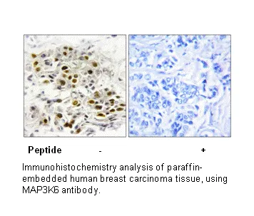 MAP3K6 Antibody - image 1