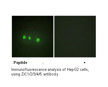 ZIC1/2/3/4/5 Antibody - image 1