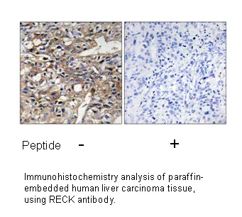 RECK Antibody - image 2