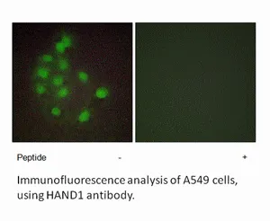 HAND1 Antibody - image 1