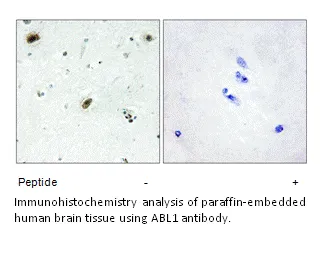 ABL1 Antibody - image 1