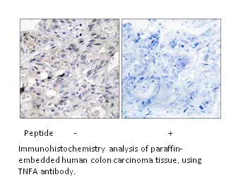 TNFA Antibody - image 1