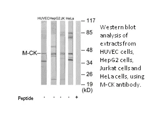 M-CK Antibody - image 2
