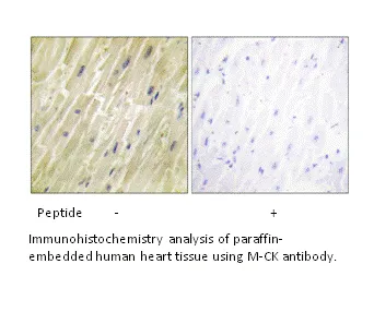 M-CK Antibody - image 3