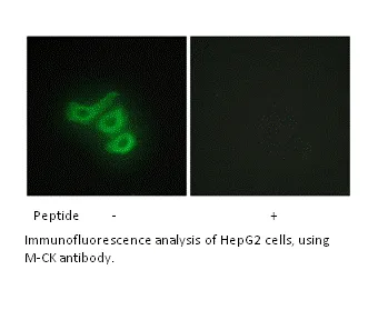 M-CK Antibody - image 1