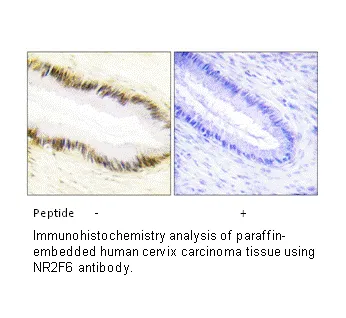 NR2F6 Antibody - image 2