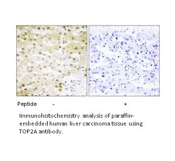 TOP2A Antibody - image 2