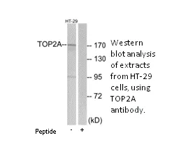 TOP2A Antibody - image 3