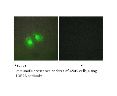 TOP2A Antibody - image 1