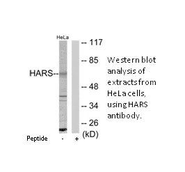 HARS Antibody - image 2