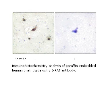 B-RAF Antibody - image 1