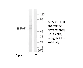 B-RAF Antibody - image 2