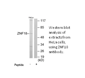 ZNF18 Antibody - image 1