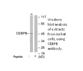 CEBPB Antibody - image 1