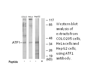 ATF1 Antibody - image 2