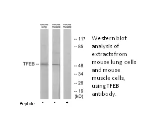 TFEB Antibody - image 1