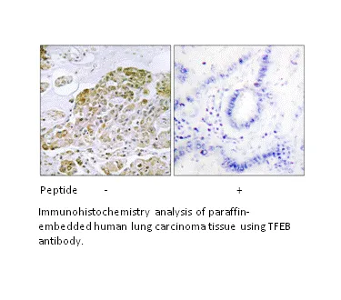 TFEB Antibody - image 2