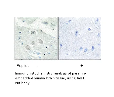 JAK1 Antibody - image 2