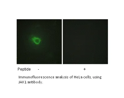 JAK1 Antibody - image 1