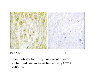 TF2E2 Antibody - image 1