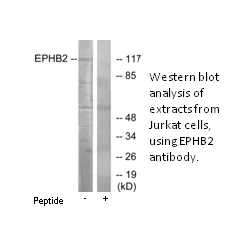 EPHB2 Antibody - image 1