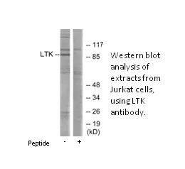 LTK Antibody - image 1