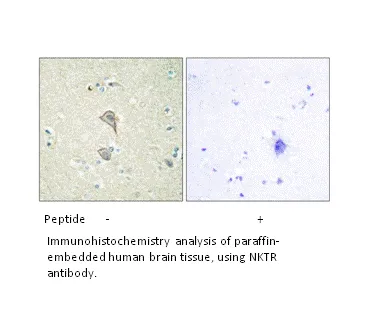 NKTR Antibody - image 1