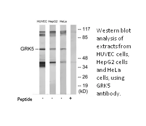 GRK5 Antibody - image 1