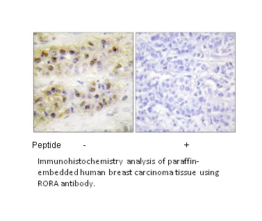 RORA Antibody - image 1