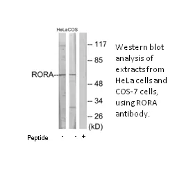 RORA Antibody - image 2