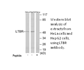 LTBR Antibody - image 2