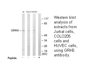 GRK6 Antibody - image 2