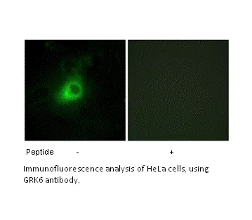 GRK6 Antibody - image 1