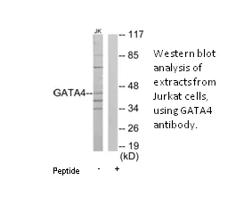 GATA4 Antibody - image 1