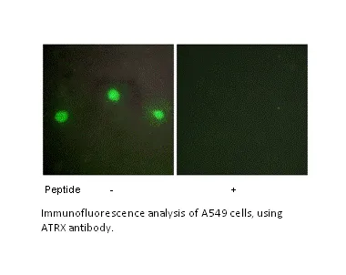 ATRX Antibody - image 1
