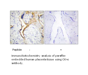CKI-ε Antibody - image 2