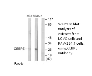 CEBPD/E Antibody - image 1