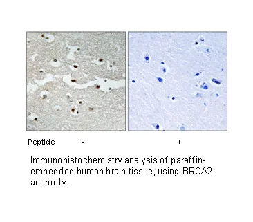 BRCA2 Antibody - image 1