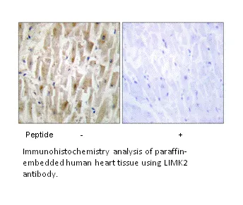 LIMK2 Antibody - image 2