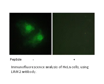 LIMK2 Antibody - image 1
