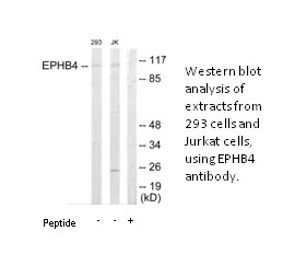 EPHB4 Antibody - image 1