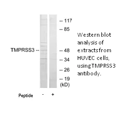 TMPRSS3 Antibody - image 2