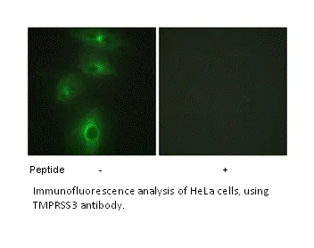 TMPRSS3 Antibody - image 1