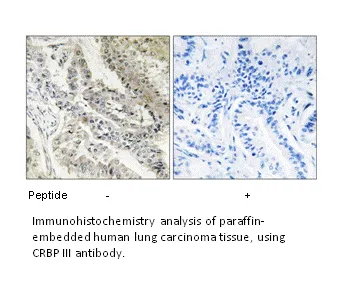 CRBP III Antibody - image 2